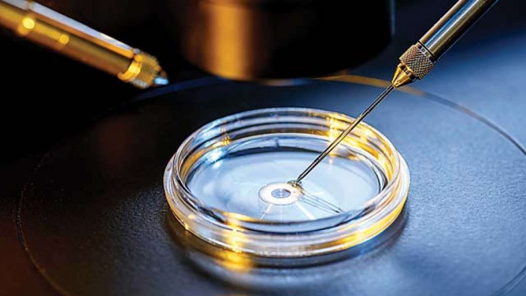 IVF treatment in Varanasi