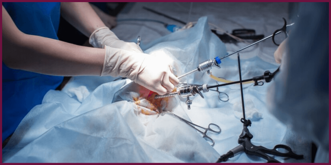 Laparoscopic Surgery